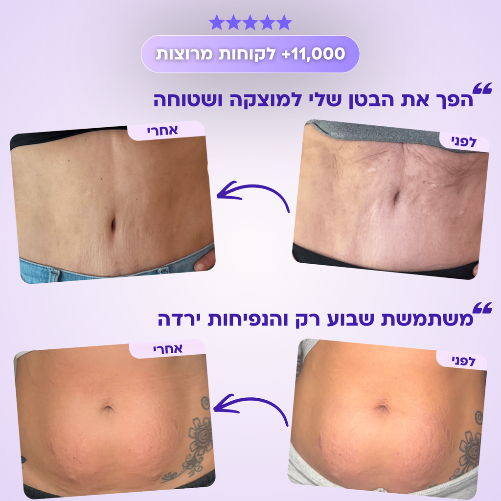 סרום FitX לחיטוב הבטן