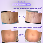 סרום FitX לחיטוב הבטן
