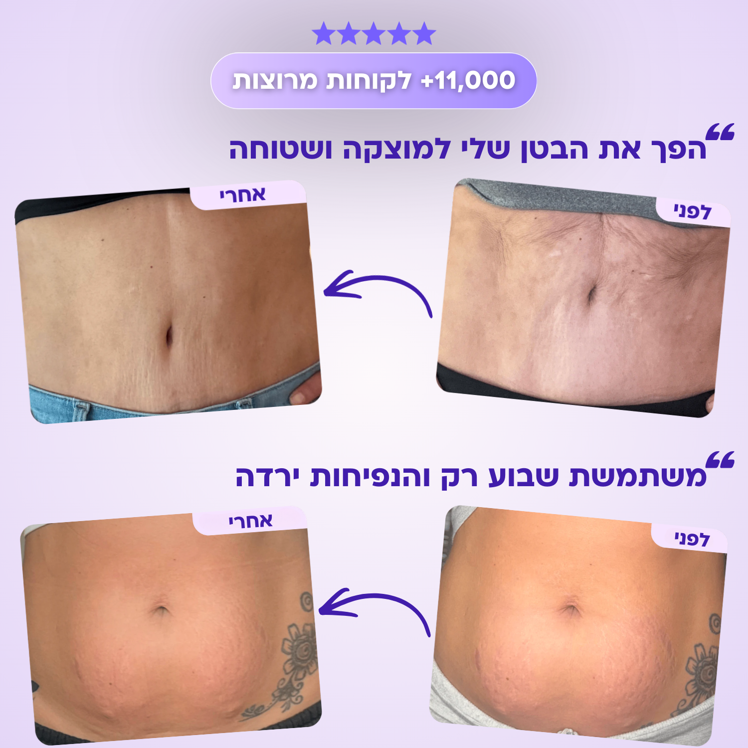 סרום FitX לחיטוב הבטן